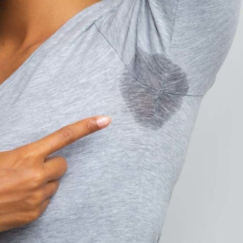 Excess Sweating (Hyperhidrosis)
