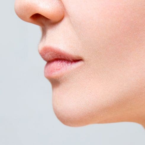 Weak Chin & Jaw