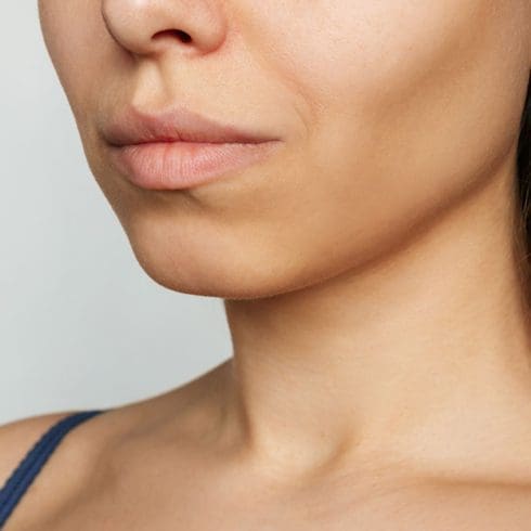 Hollow Face / Volume Loss