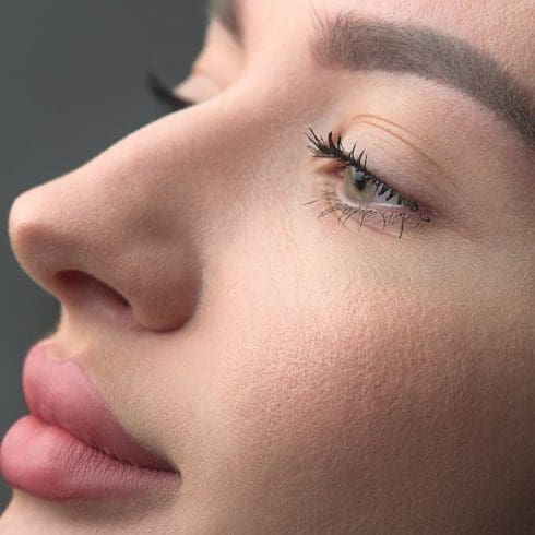 Misshapen Nose
