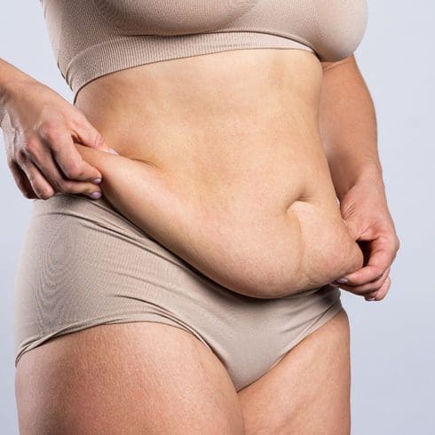 Loose Tummy Skin