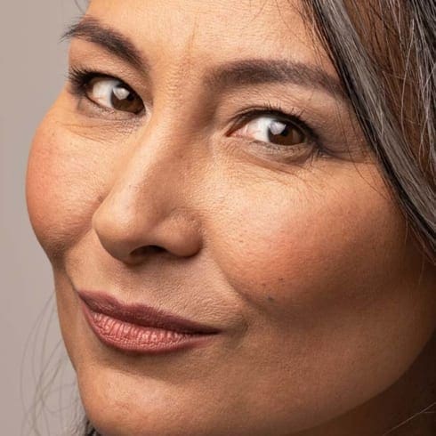 Anti Wrinkle Injections Gerrards Cross